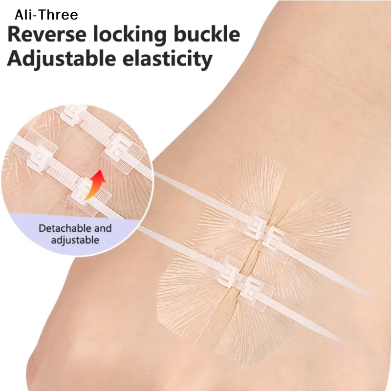 

Аварийная застежка на рану, шов на молнии, повязки, ремонт ранов без швов для активного отдыха, быстрый сгусток ран