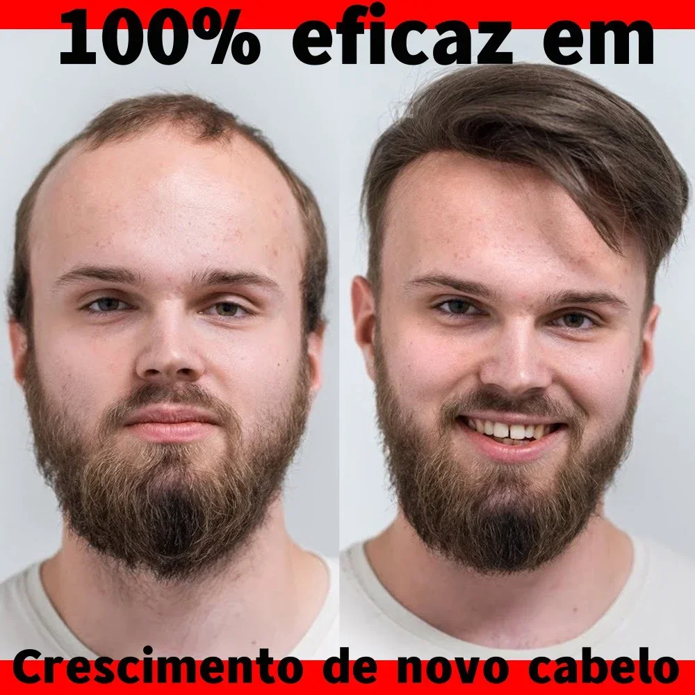 Cabelo nutritivo e cuidado para homens e mulheres, cabelo de mulher