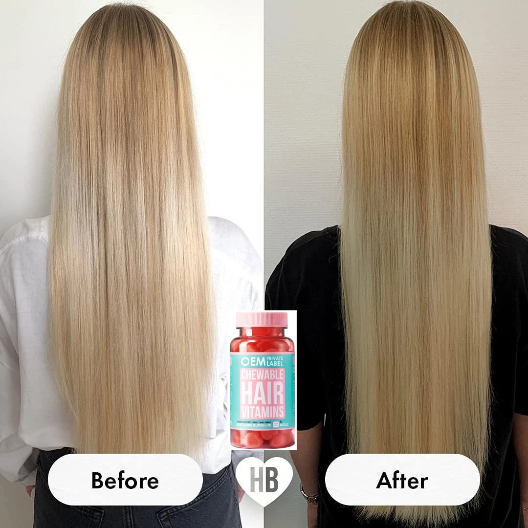 

Hair vitamin gummies regulate metabolism, promote hair growth, and maintain scalp health Health food