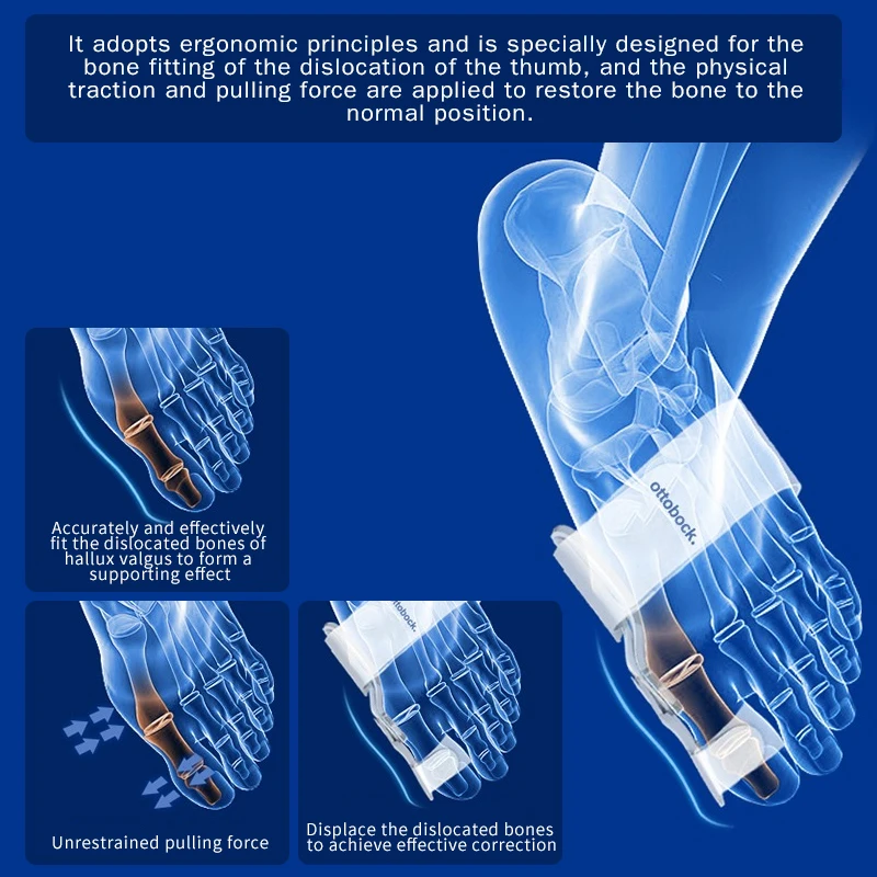 Corrector de juanetes Hallux Valgus, separador de dedos de los pies, cuidado de los pies, Corrector de juanetes Haluksy, 1/2 piezas