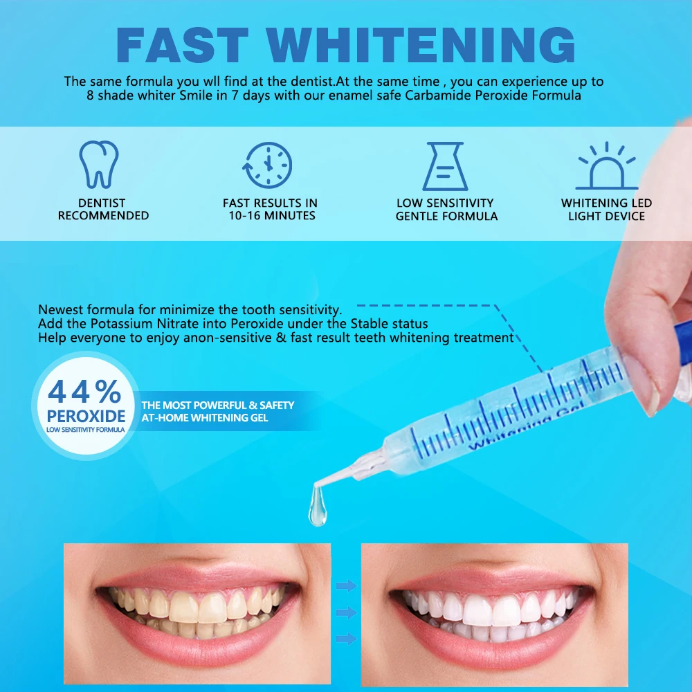 Mybys Zahn Zahn aufhellung sgel Peroxid Mundpflege Zahn reiniger Werkzeug tragbares Blaulicht Bleich system Heimgebrauch