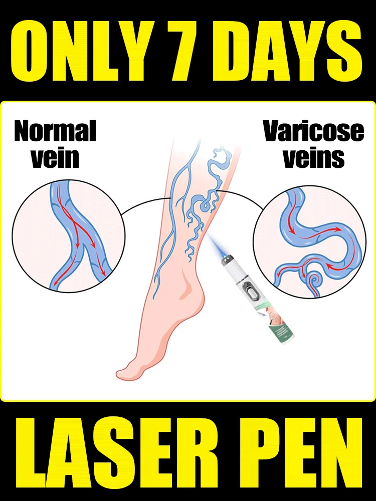 

Laser Therapy Leg Repair Pen, Athletic Performance and Recovery