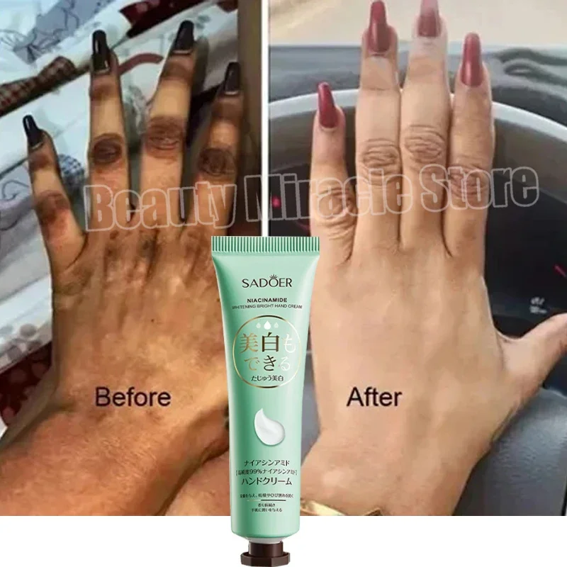 

Fast Whitening Dark Knuckles Brighten Hand Cream Melanin Corrector Moisturizing Intense Stains Remover Cosmetics Skin Care 2024