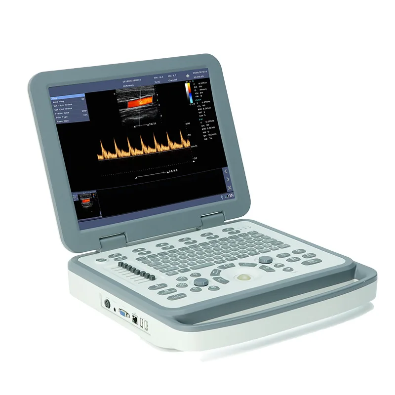 Special Color Notebook B Ultrasound Machine for Animal Hospitals Economical Veterinary Diagnostic Equipment
