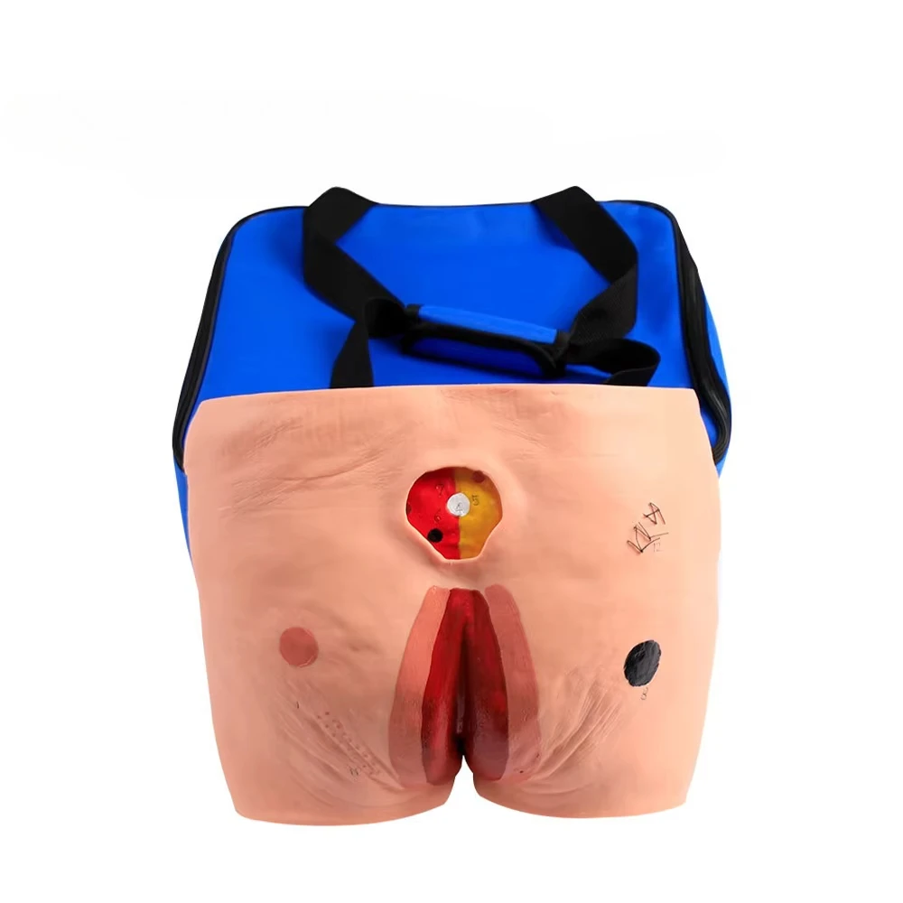 Bedsore Nursing Learning Model Medical Science Old 4-stage Bedsore Nursing Model Pressure Sore Wound Nursing Training