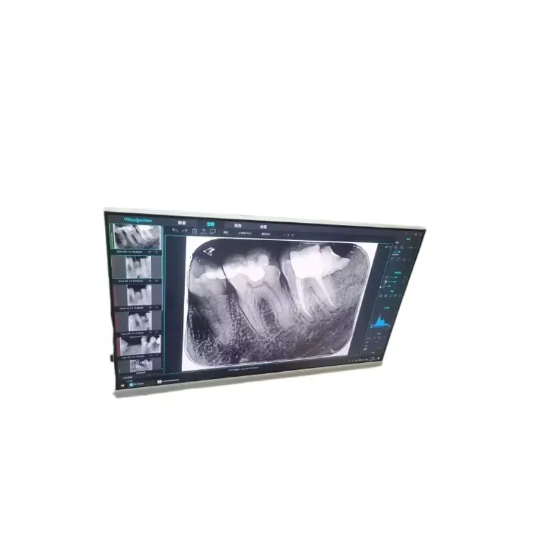 Intraoral Camera That Can Be Installed with Digital Sensor Software with 24inch Touch Screen