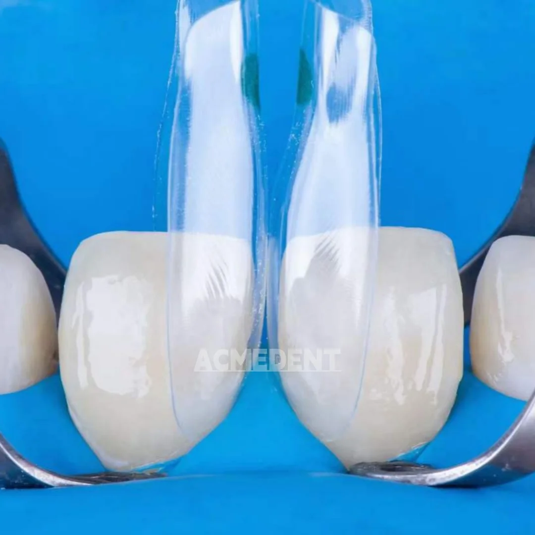 20pcs-black-triangle-bt-dental-matrix-clear-matrices-mylar-matrice-bands-close-gap-fits-bioclear-aesthetic-restorations