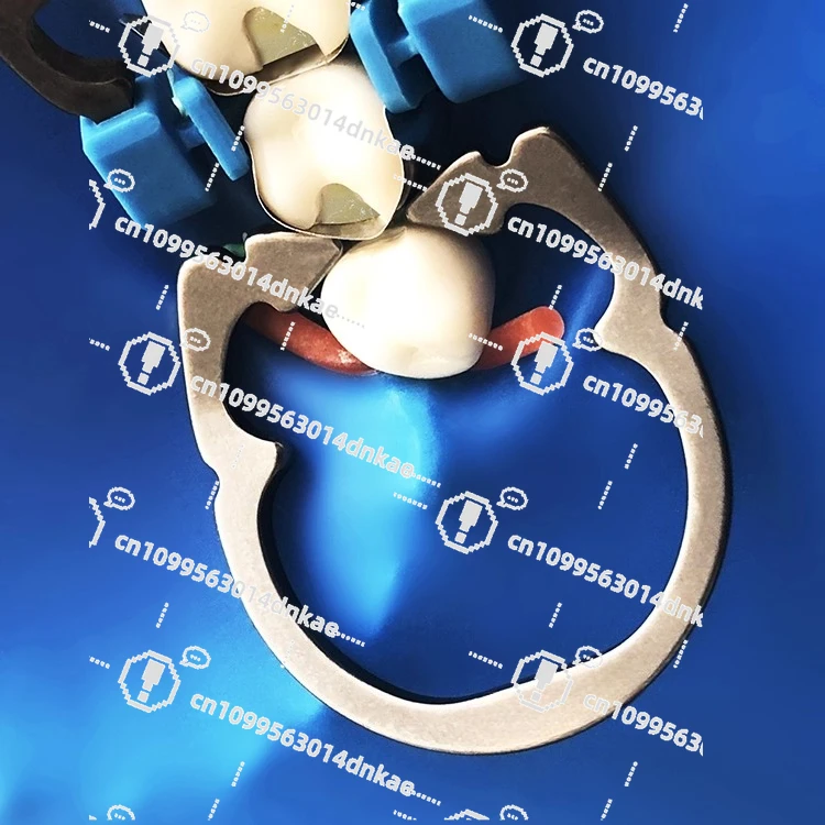 R1 Nickel-titanium Tooth Splitting Ring, Tooth Splitter, Forming Piece Clamping Ring, Tooth Splitting Without Impaction, Oral