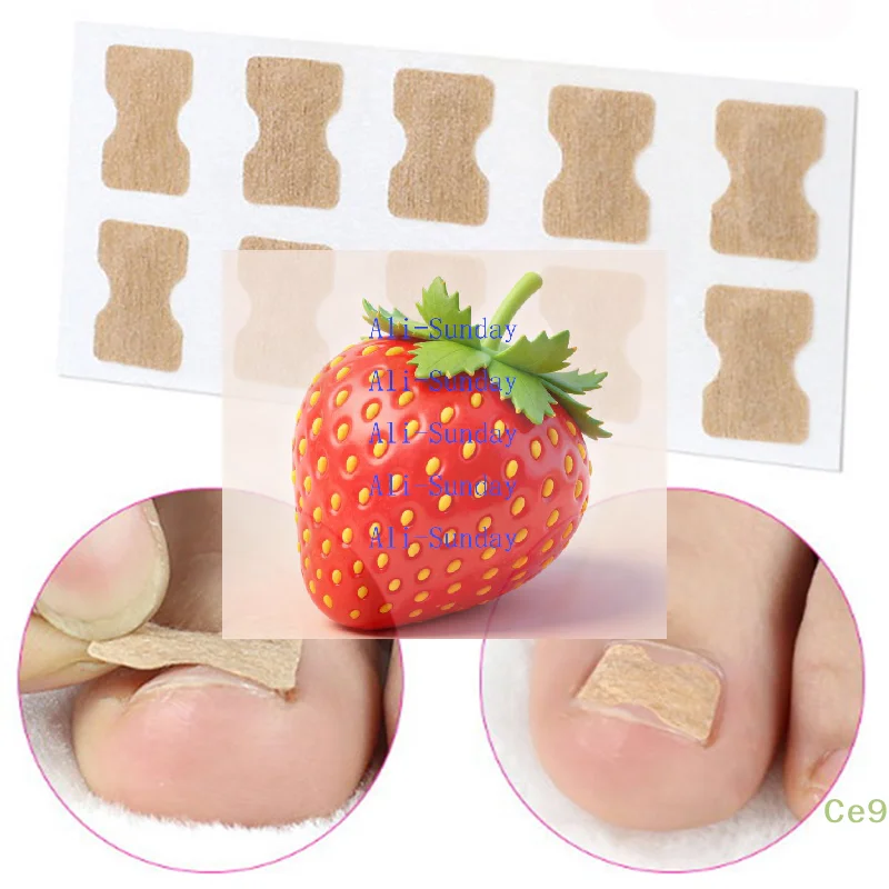 10PCS Ingrown Toenail Correction Patches - Pedicure Brace Straightener Tools