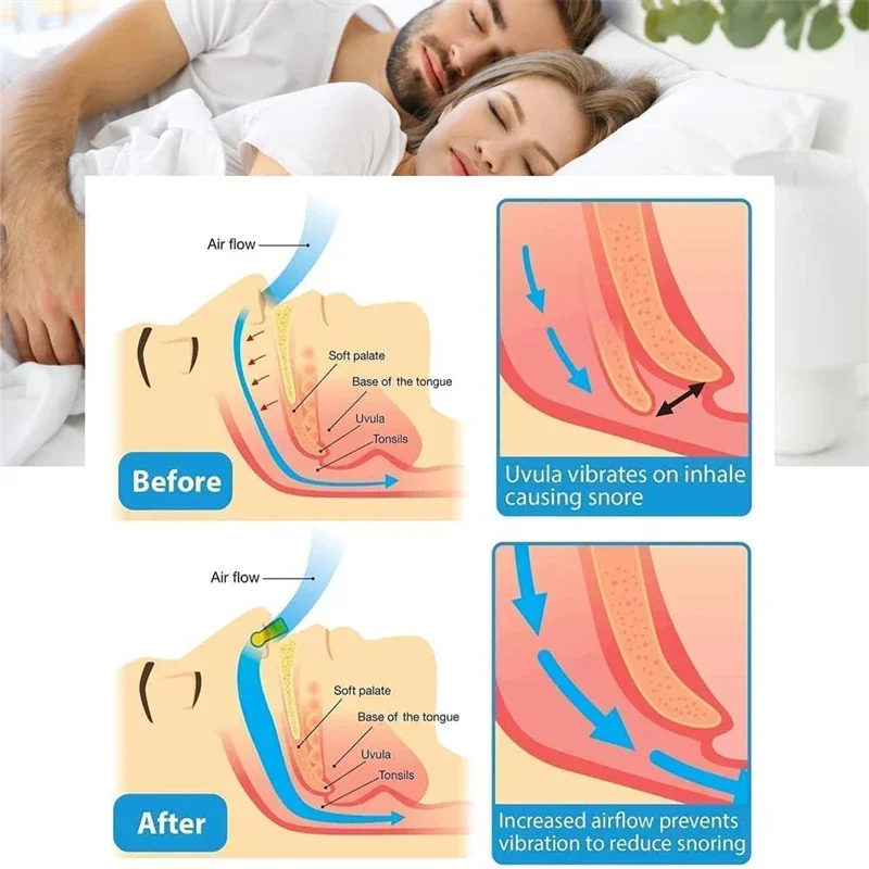 Anti Snore Stop Snoring Nose Clip Silicone Magnetic Sleep Tray Sleeping Aid Apnea Guard Night Device with Case Snoring Solution