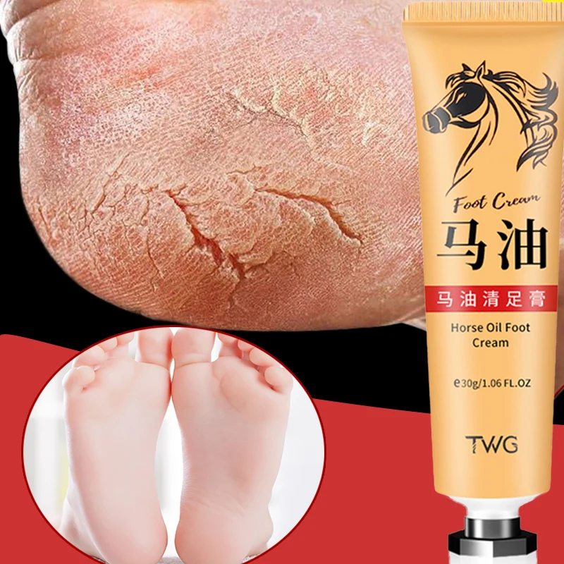 Anti Crack Foot Cream tallone riparazione screpolata crema all'olio di cavallo rimozione liscia pelle morta callo Anti-essiccazione piedi per le mani cura della pelle 30g