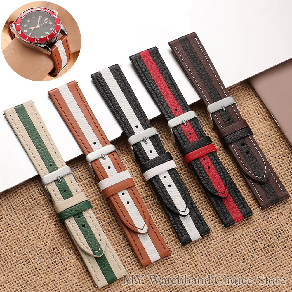 20mm 22mm Leder-Uhrenarmband mit Schnellverschluss für Herren und Damen, Uhrenband für Samsung Galaxy, hochwertiges Business-Uhrenarmband aus Rindsleder
