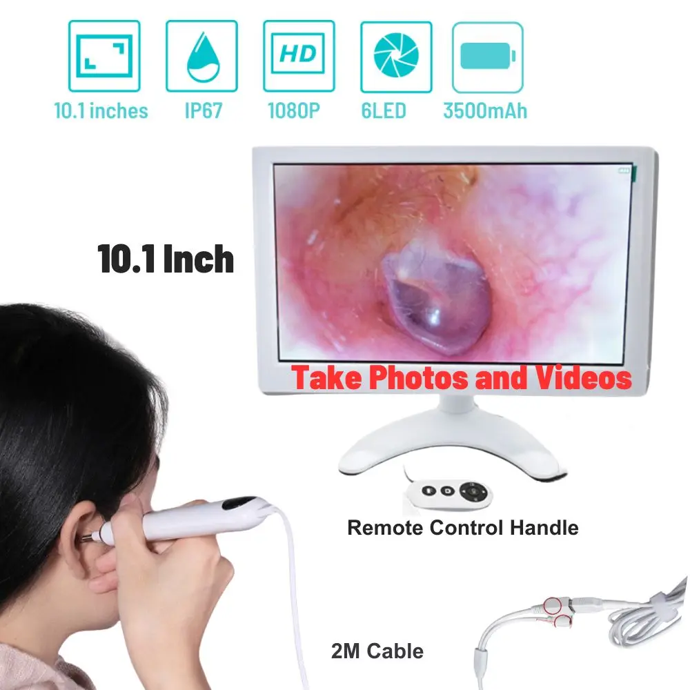 

10.1-Inch Screen Digital Otoscopio Ear Cleaning Endoscope 1080P Visual Otolaryngoscope ENT Camera Cleaner Tool Home Clinic Use