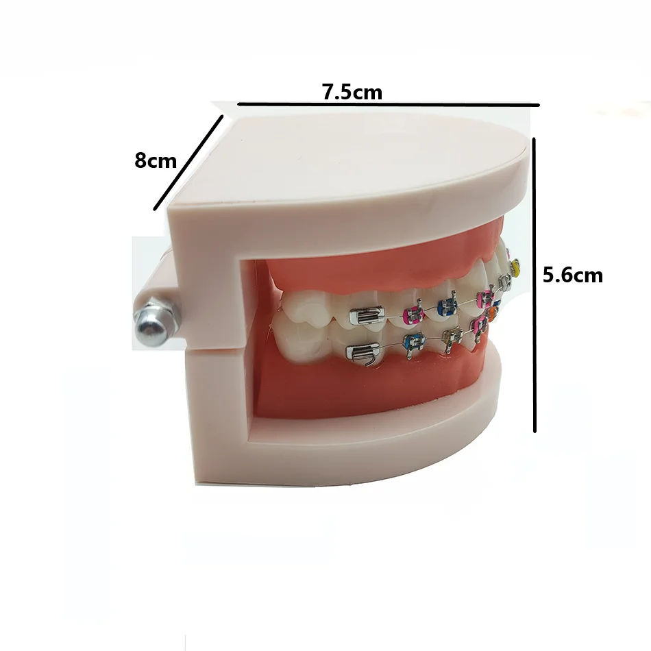 Dental Orthodontic Treatment Model with Ortho Metal Ceramic Bracket Arch Wire Buccal Tube Ligature Ties Dentist Tools Lab