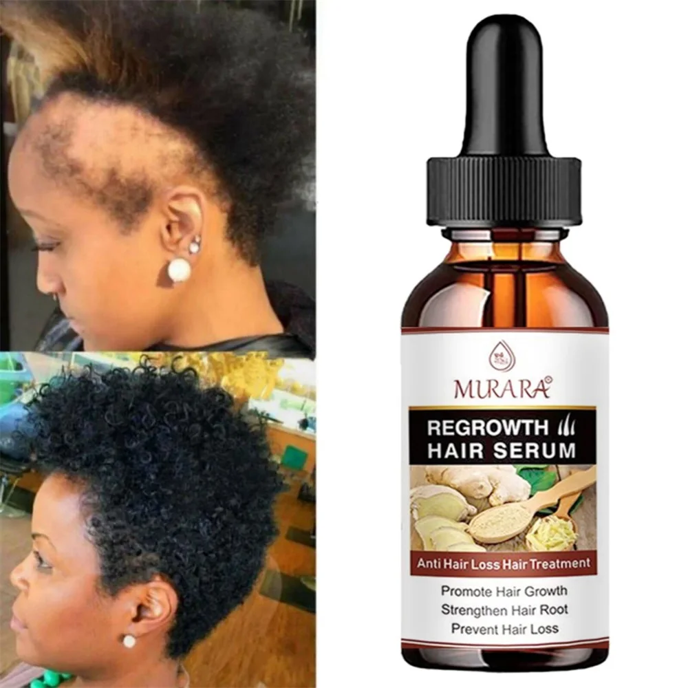 TRSTAY Hair Growth Oil has good permeability, penetrates deep into the hair core, fully absorbs nutrients,and deeply moisturizes