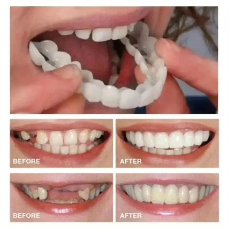 DIY Smile Correction Kit for Men & Women-Comfortable,Natural White Top&Bottom Set-Perfect for Hiding Gaps,Stains&Missing Teeth