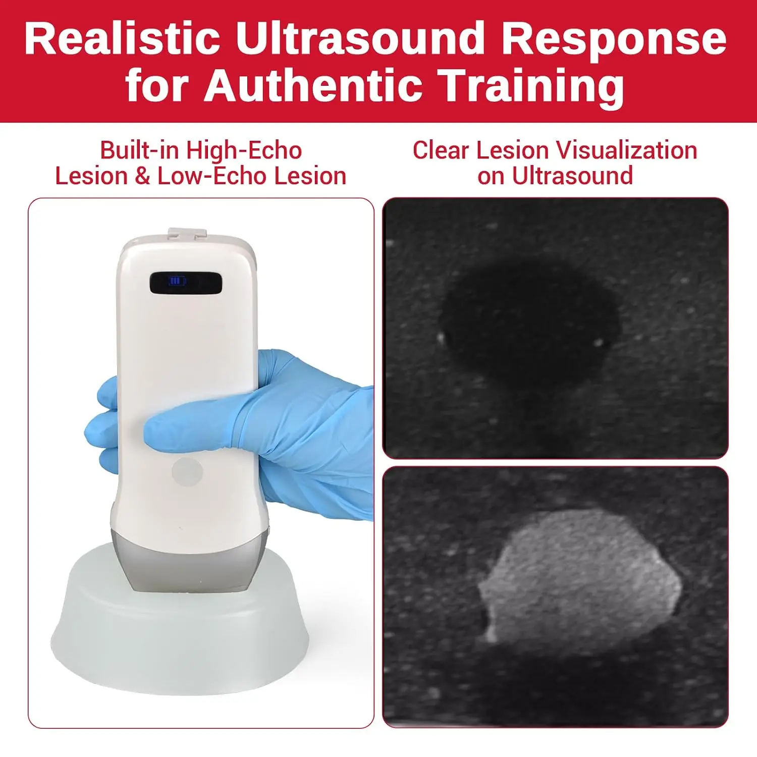 Ultrassist Puncture Silicone Model Ultrasound-guided Simulated Pathological Nodules Replicate Real Injuries for Medical Student