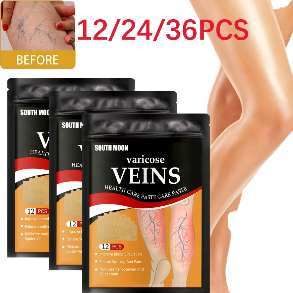 12/24/36PCS Varicose Veins Ointmnet Vasculitis Phlebitis Spider Cream Varicosity Angiitis Removal Herbal Medical Plaster