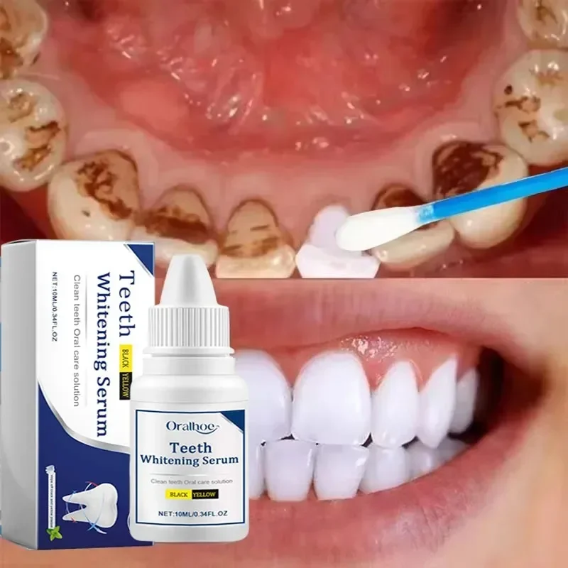 

Cleaning Tooth Whitening Serum Remove Plaque White Teeth Gel Teeth Yellow Smoke Stains Toothpaste Fresh Breath Oral Hygiene Care