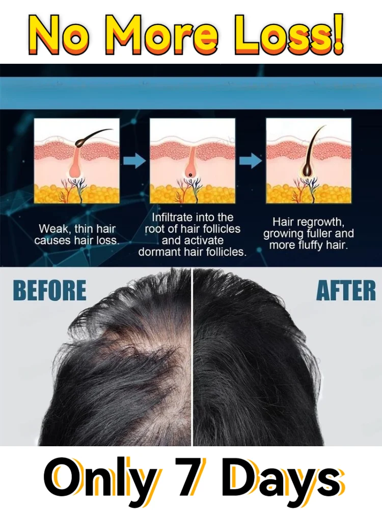 

Fine hair thickener, quickly amplifies hair density and strengthens strands, get the thick hair look you want