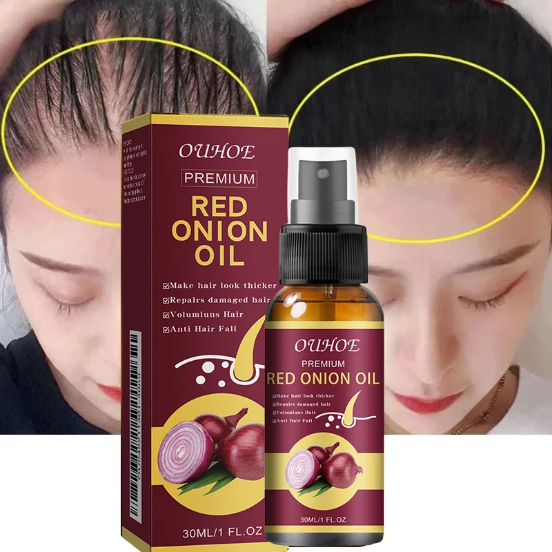 Onion Hair Growth Oil Spray For Men Women Thickening Hair & Scalp Treatment For Hair Loss Fast Hair Growth Serum Products 30ml