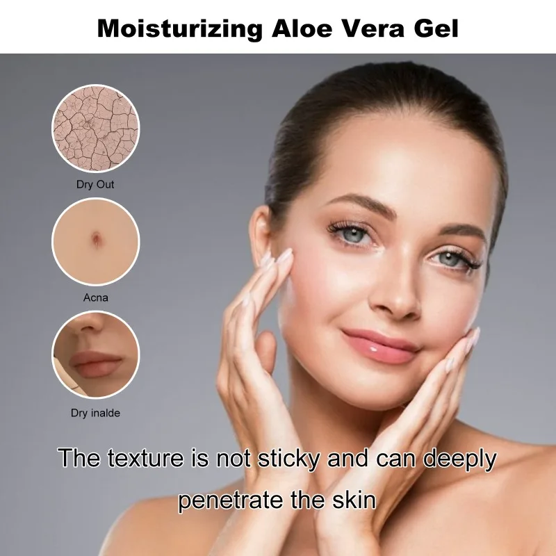 Aloe Vera Moisturizing Gel Repairs Facial Acne Redness Hydrates Dilutes Pores Tightens Anti-wrinkle Skin Whitening Removal Gel