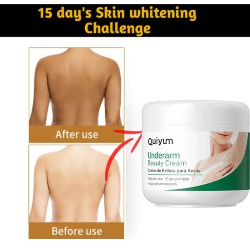 

Hot sales Effective Improve Body Whitening Cream Armpit Legs Knee Elbow Bleaching Cream Dull Remove Dark Spots Melanin Brighten