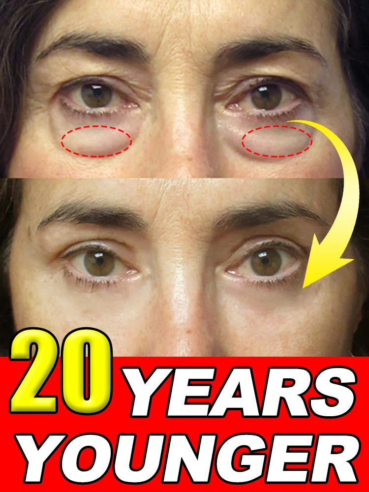 

Instantly removes under eye bags, reduces fine wrinkles, improves skin elasticity, eliminates dark circles, brightens the eye ar