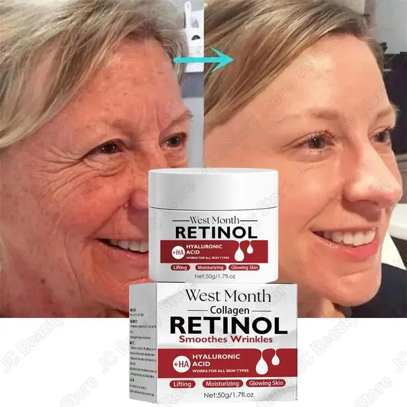 

Retinol Wrinkle Remover Face Cream Firming Lifting Anti Aging Fade Fine Lines Moisturizing Whitening Repair Skin Care Cosmetics