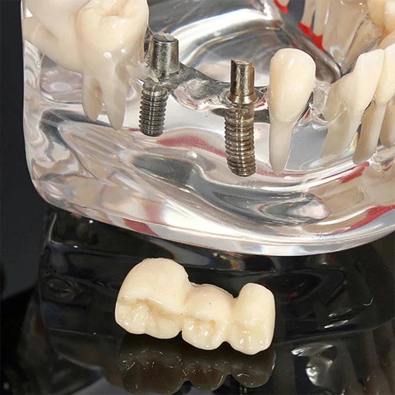Thumbnail 4 - #23 Ranked Dental Teaching Models Picks in 2026