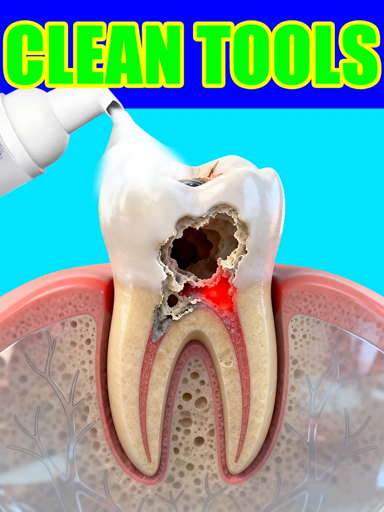 2025 hotsale ترقية جديدة 3.0 أدوات تنظيف موس داخل الفم، تصنيف عالي، للجنسين، شحن مجاني #1