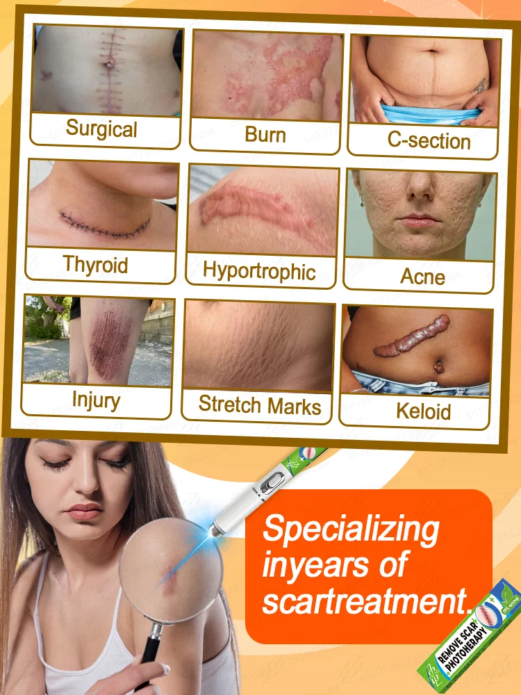 2025 latest laser pen, repair various scars