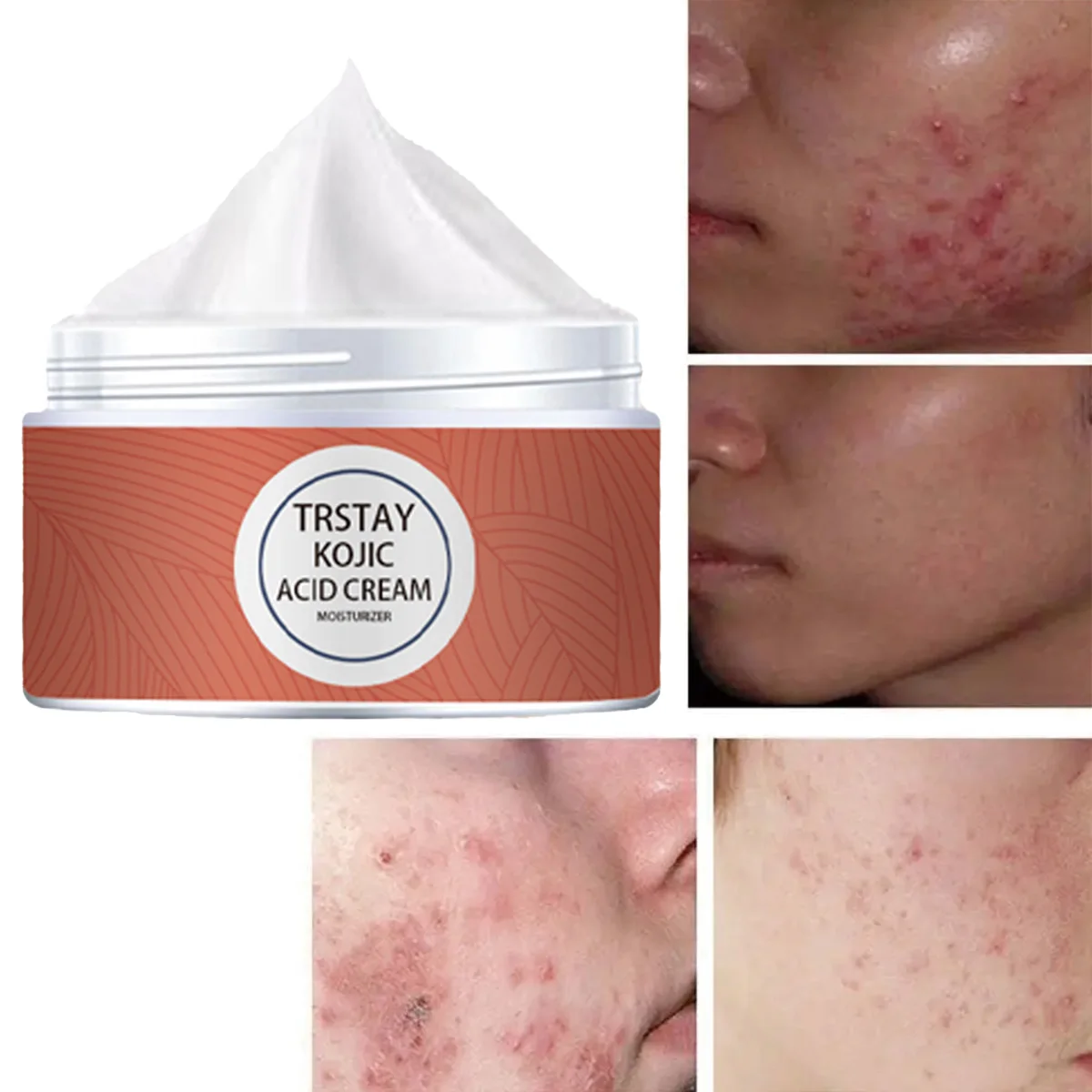 

TRSTAY увлажняющий крем с койевой кислотой для отбеливания кожи, удаления прыщей, против морщин, укрепляющий и увлажняющий уход за лицом