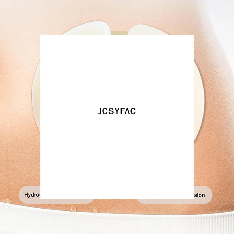 

10 шт. Адгезивные фиксирующие кольца-полоски для стомы/колостомы, предотвращающие протечки, для калоприемников