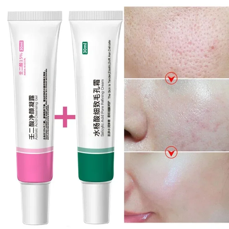 Get Rid of Closed Acne Blackheads Smooth The Skin Gel Moisturizing Shrinking Pores Improving Dry Skin Salicylic Acid Acne Cream