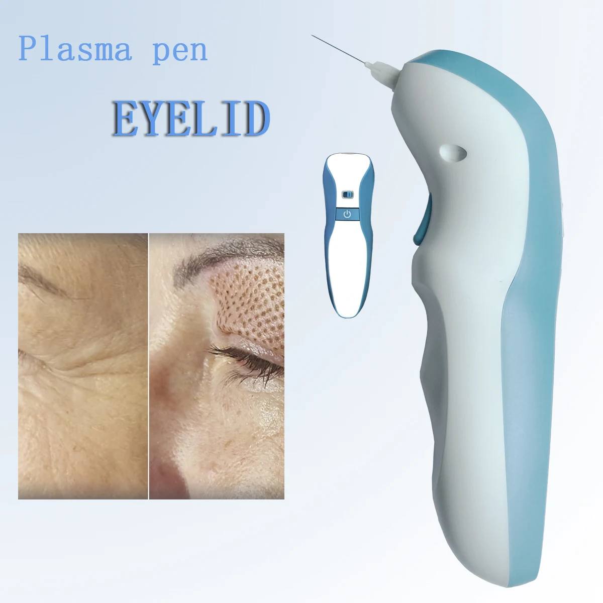 Fibroblast Plasma Pen For Eyelid Lift Face Skin Lifting Wrinkle Spot Mole Dark Spot Freckle Nevus Wart Skin Tag Tattoo Removal