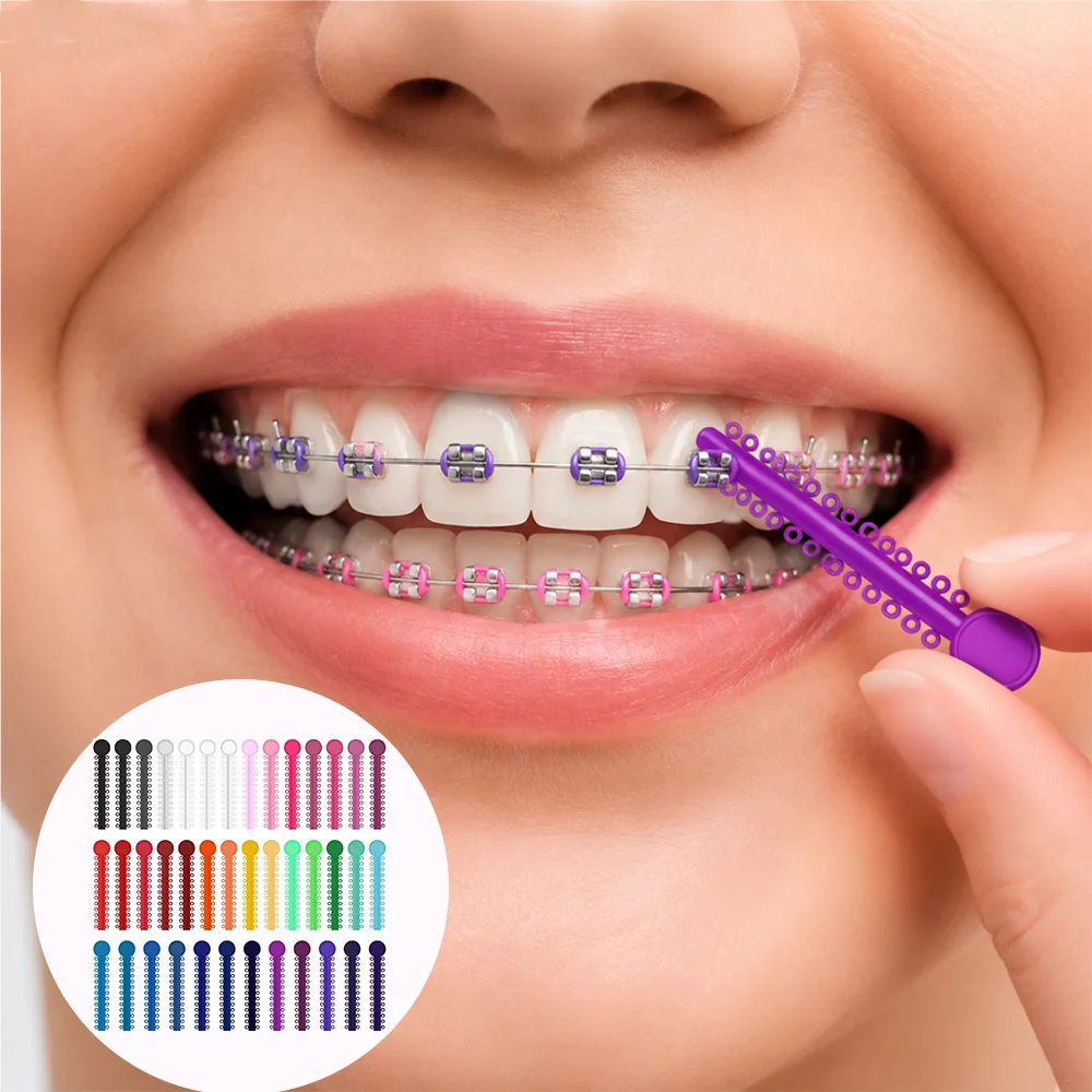 Mehrfarbige orthodontische elastische O-Ring-Gummibänder, mehrfarbige zahnärztliche Ligatur-Gummibänder, orthodontisches Ligaturring-Set - O-Ring-Zahnligaturringe für orthodontische Behandlung und Zahnspangen, 48 Farbe – Detail 5