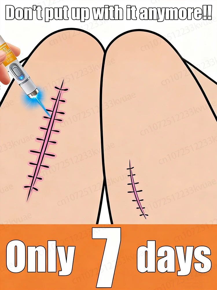 

Sᴄɪᴇɴᴛɪғɪᴄ sᴄᴀʀ ʀᴇᴍᴏᴠᴀʟ, ʟᴀsᴇʀ sᴄᴀʀ ʀᴇᴍᴏᴠᴀʟ.