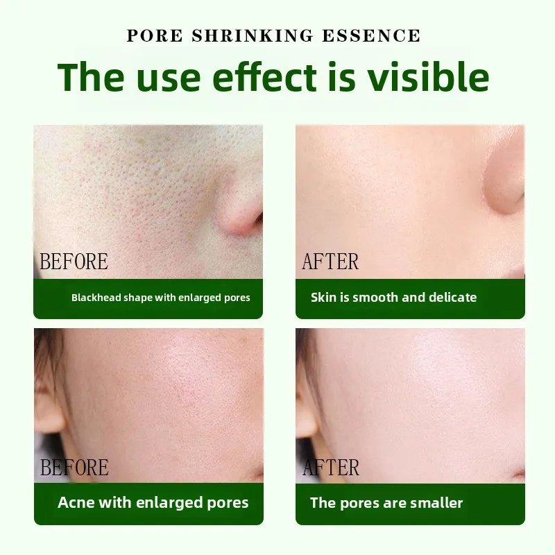 Salicylic Acid Pore Refining Essence Serum hydrating and moisturizing caring for and shrinking pores tightening skin liquid