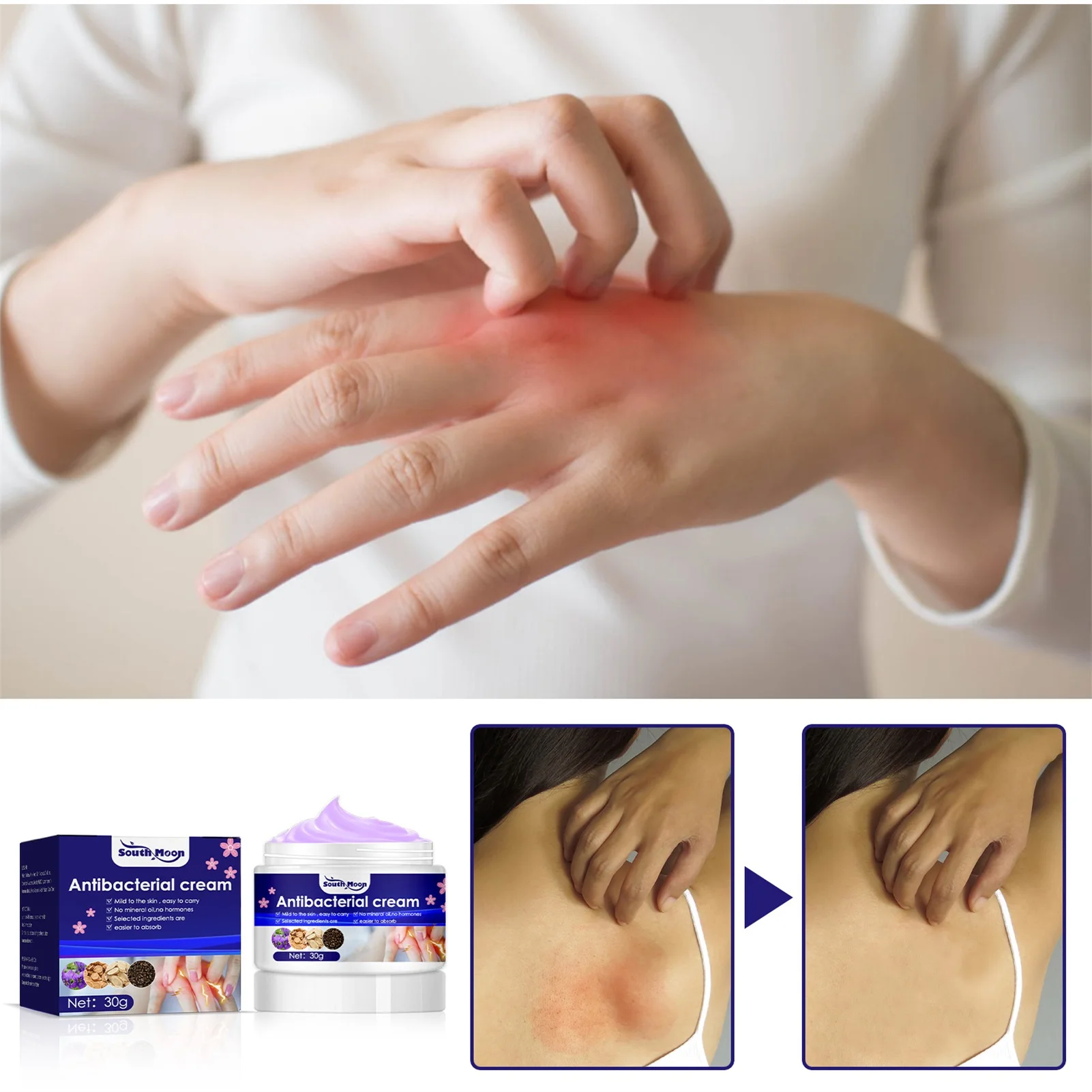 Itching Cream For Skin Anti-Itch Cream For Itch Relief Moisturizing Cream For Itch Relief Repair Cracked Hands And Feet Mild To