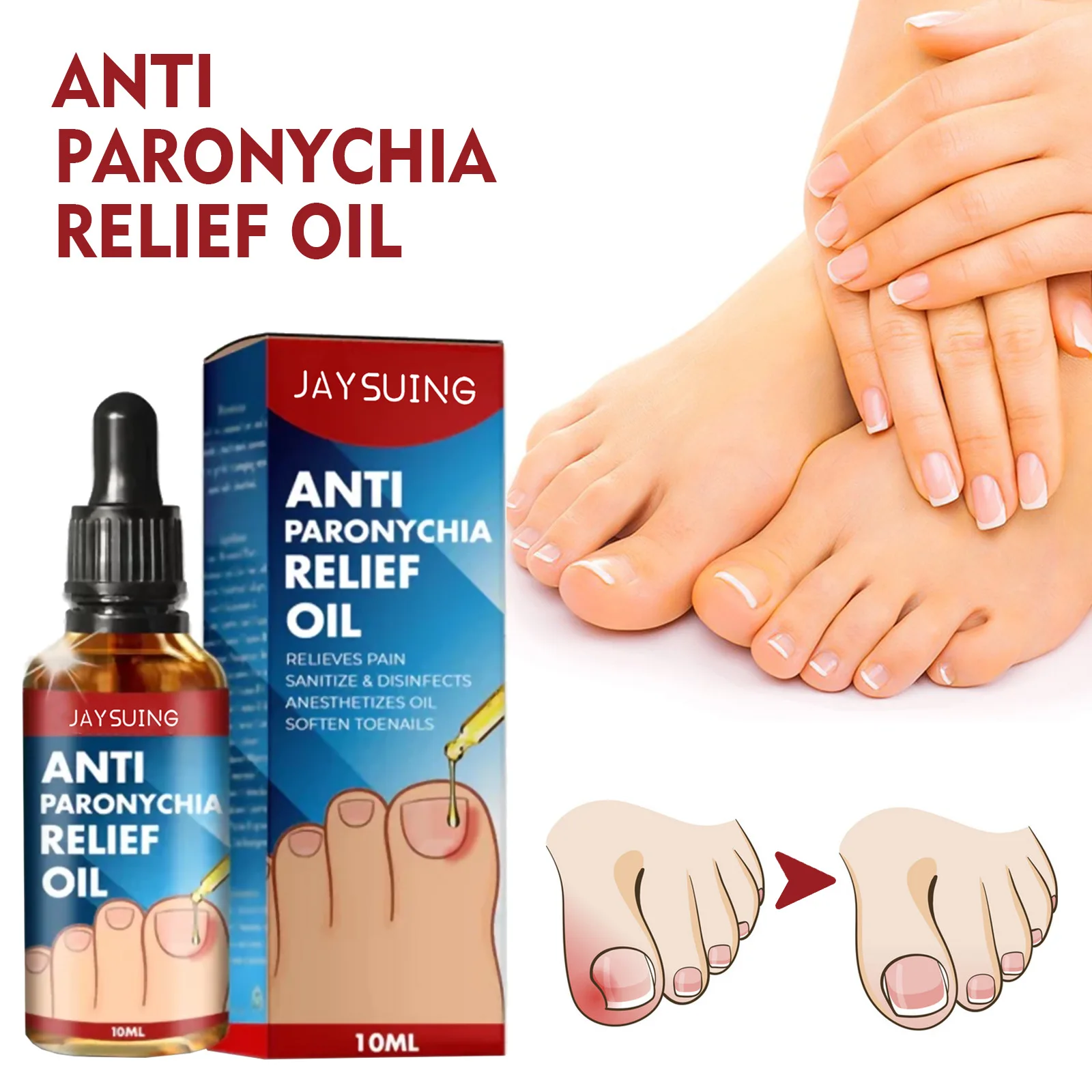 발톱무좀 10ML Ingrown Toenail Drops Ingrown Toenail Relief Oil Portable Ingrown Toenail Removal Drops Essential Oil Solution uñas