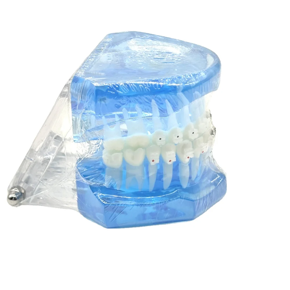 Рисунок 4 - Модель зубных протезов Полуметаллический