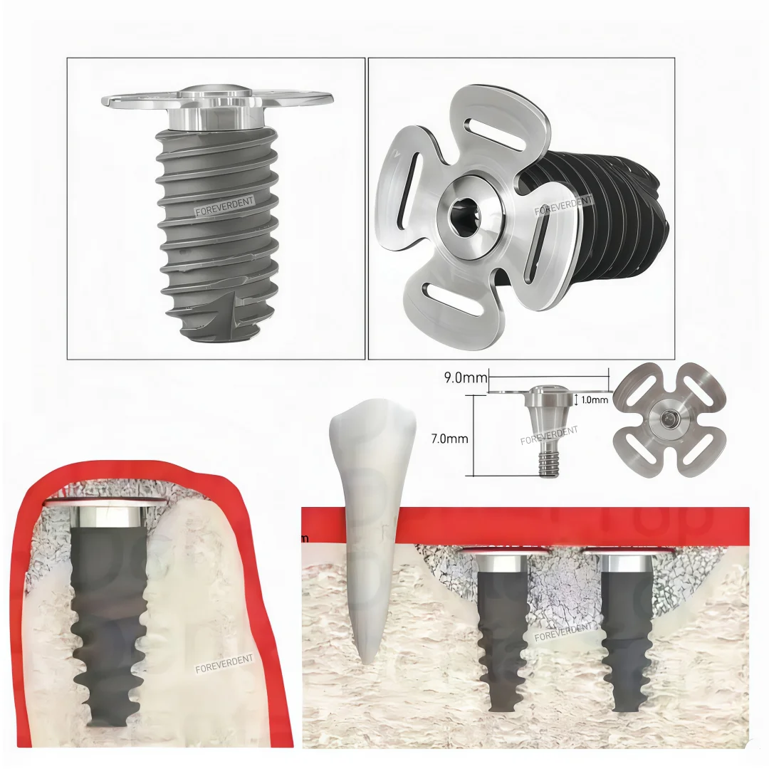 Dental Accessories Auodonta Sinus Base Table Screw Titanium Alloy Dental Implant Accessories Sinus Base Cap