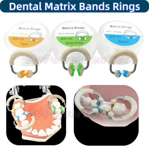 Bandas de matriz Dental, anillos, Clip de matrices, abrazadera separadora 3D, ajuste de titanio, guarnición