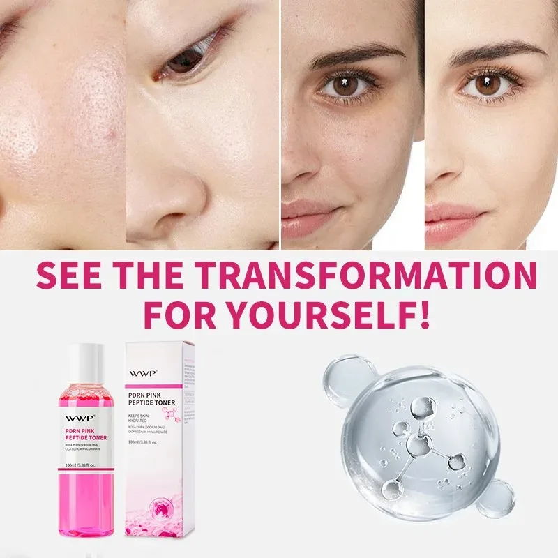 100 مل الببتيد الوردي PDRN منشط المياه ترطيب تونر الوجه ترطيب جوهر