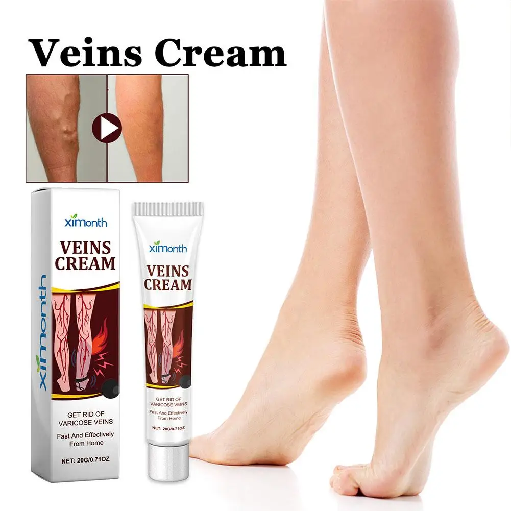 Crema per trattamenti delle vene efficace per alleviare le gambe vasculite dilatata flebite Formula naturale unguento per vene Varicose