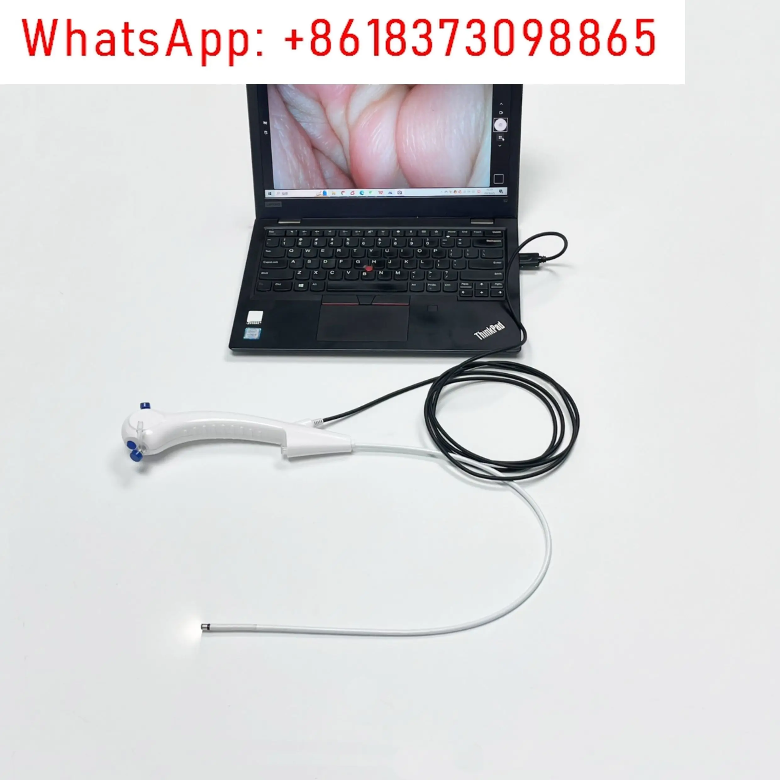 Pet veterinary endoscope soft mirror bronchoscope foreign body biopsy high definition can be connected to the computer