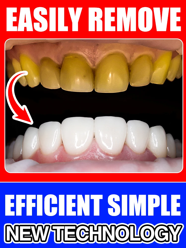 

Teeth whitening, dental care, tooth stain removal