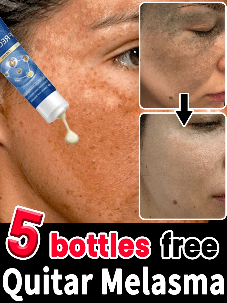 

Natural Spot Lightener - Plant-Based Formula for Sensitive Skin