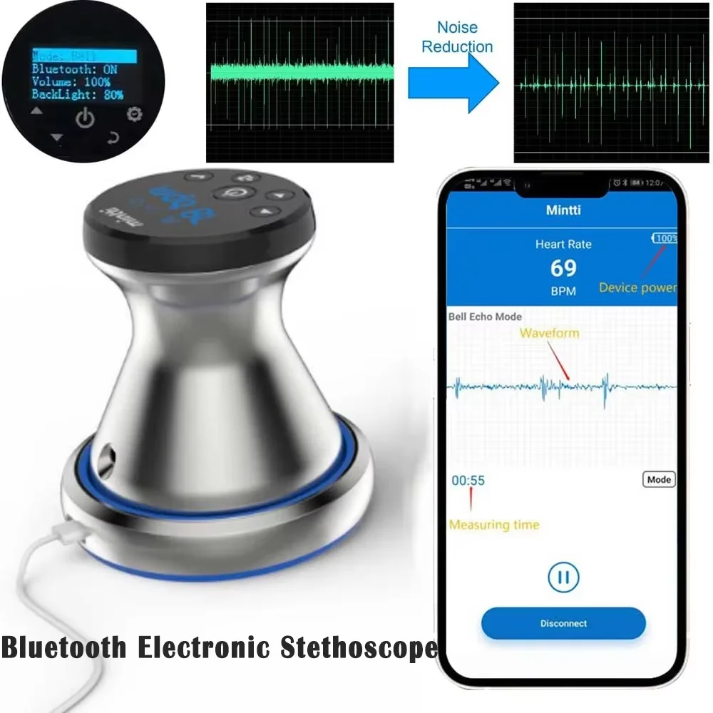 Intelligent Wireless Bluetooth Stethoscope For Real-Time Transmission Of Cardiopulmonary Electronic Stethoscope With Application